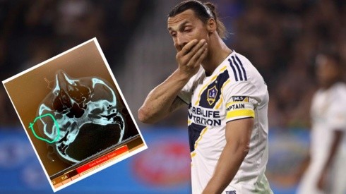 ¿Pelota o mala onda? Ibrahimovic fractura a rival en el clásico de Los Ángeles (Foto: Getty Images y Amro Tarek)