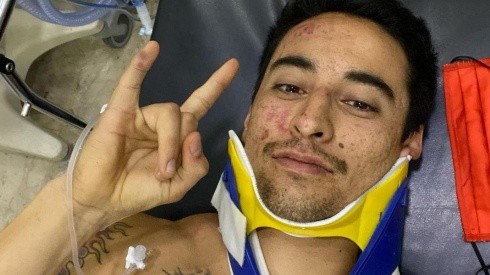 El chileno se realizará exámenes médicos para evaluar las lesiones en su cabeza.