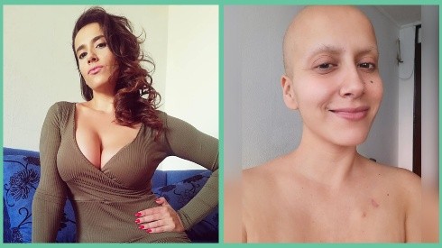 El antes y el después del tratamiento contra el cáncer de Mila Correa, quien ha registrado exhaustivamente el proceso en su Instagram.
