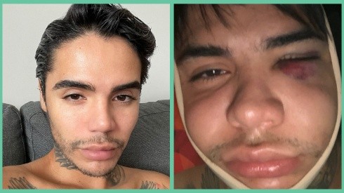 El antes y el después de Leo Méndez Jr.