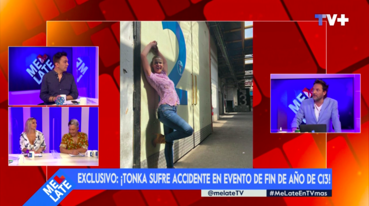 Aseguran que Tonka Tomicic se lesionó en Canal 13.(1)