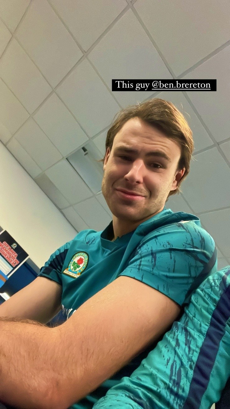 Ben Brereton lució su nuevo rostro a través de redes sociales. ¿Qué nota le pones?