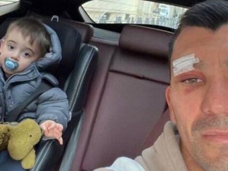 Gary Medel muestra su herida tras chocar con  Zlatan Ibrahimovic