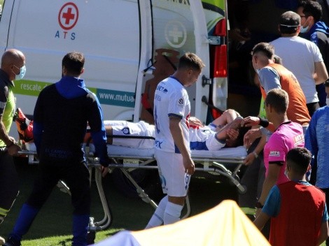 Nico Ramírez sufre espantosa fractura en el Everton-Huachipato