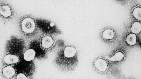 China: estudio detectó 35 contagios en personas de una nueva enfermedad de origen animal, el Henipavirus