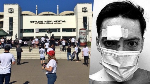 El periodista Rodrigo Arellano mostró las consecuencias del ataque que sufrió en el estadio Monumental