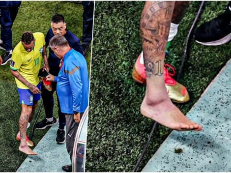 Neymar y el tobillo hinchado: esguince por trauma directo
