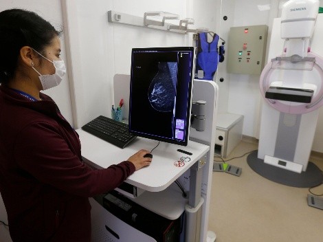 ¿Cómo hacerme la mamografía sin costo?