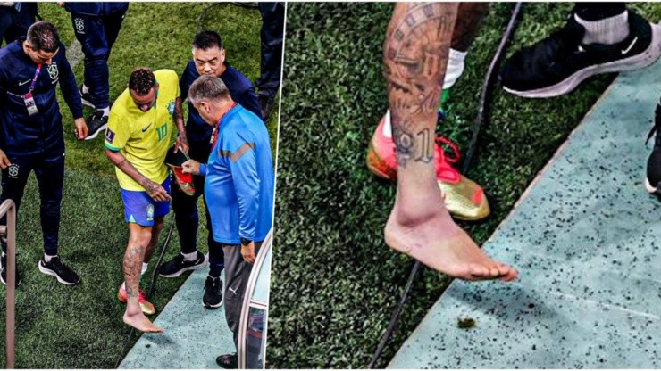 El tobillo hinchado de Neymar: esguince por trauma directo.