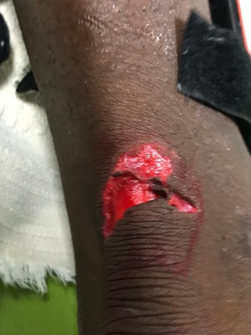 Así terminó el talón de Waterman