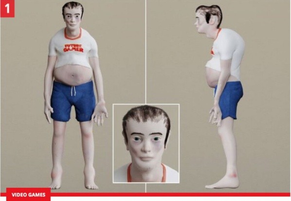 Deformidades en el cuerpo