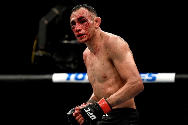 La cara de Tony Ferguson quedó con varias heridas graves tras su derrota en el UFC 249. Foto: Getty Images
