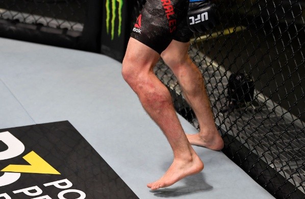 Así quedó la pierna de Vince Morales tras las patadas de Chris Gutiérrez en el UFC Vegas. Foto: Getty Images