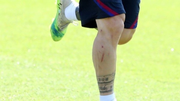 La pierna de Lionel Messi quedó con marcas tras el partido ante Sevilla - Barcelona