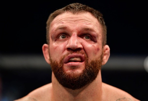 El rostro de Phillips tras recibir una paliza por parte deKhamzat Chimaev. Foto: Getty Images