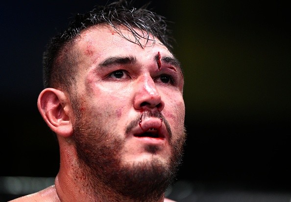 Así terminó el rostro de Augusto Sakai tras la pelea con Overeem. Foto: UFC
