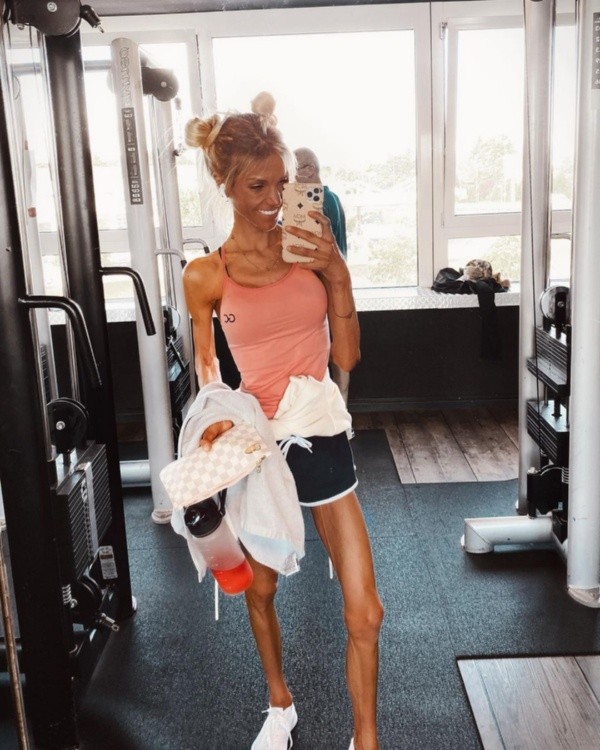 Una de las imágenes publicadas por la influencer alemana Josi Maria, cuando ya luchaba contra la anorexia.