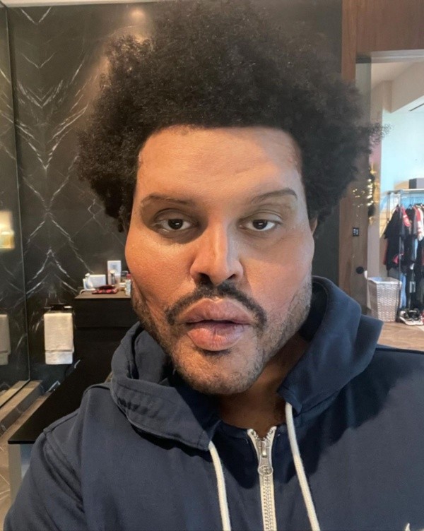 El sorprendente look que compartió The Weeknd en su Instagram y que lo llevó a ser comparado con el personaje de la serie animada &quot;Bob Esponja&quot;, &quot;Calamardo&quot; guapo.