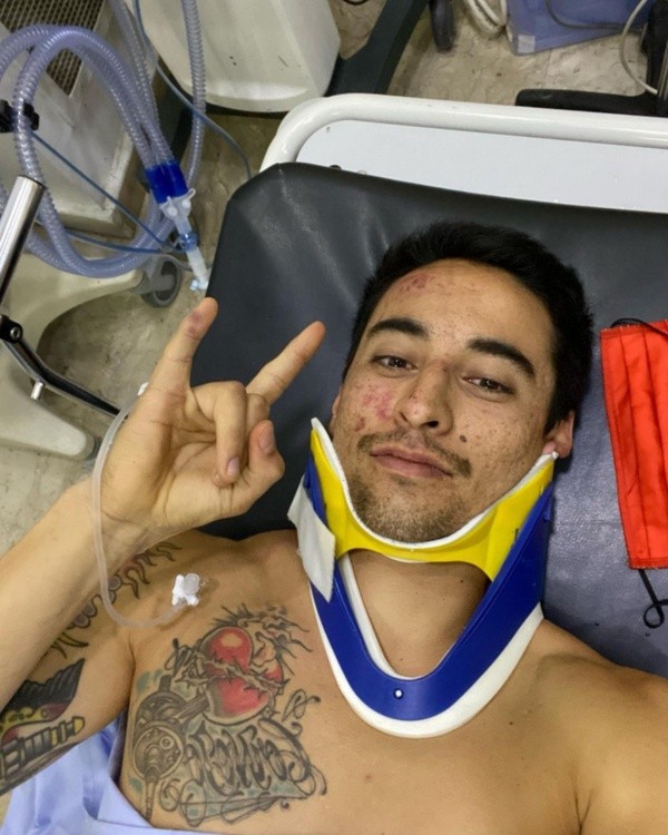 El chileno tuvo un trauma en la cabeza tras chocar en el kilómetro 252 de la décima etapa.