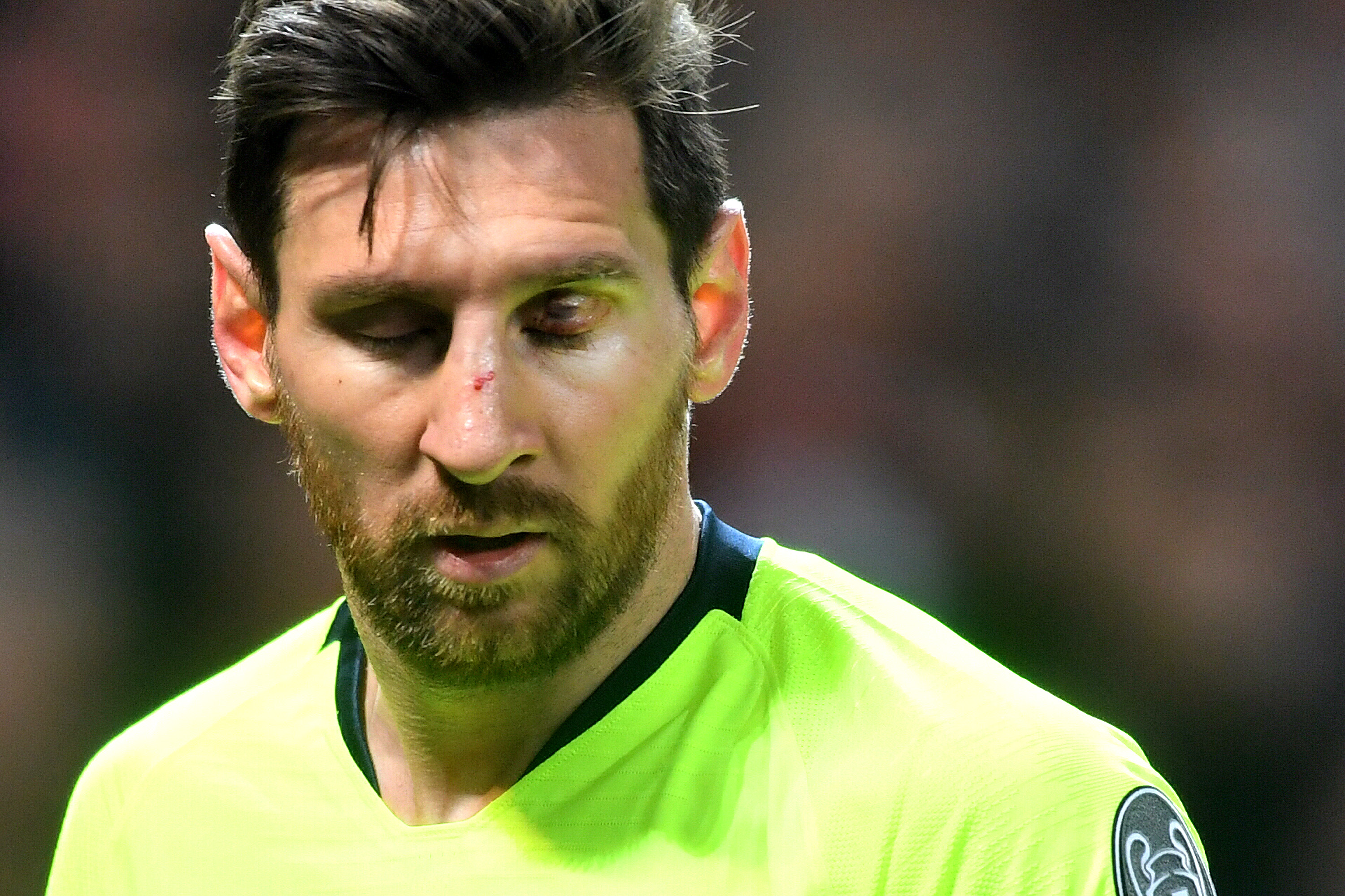 Lionel Messi salió con el rostro cortado ante el Manchester United. (Foto: Getty Images)