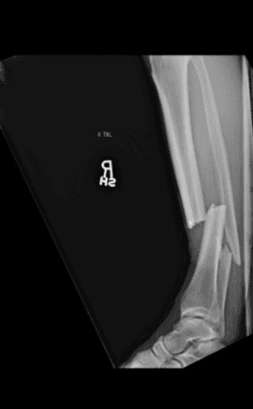 Así quedó la pierna tras la patada. Foto: Twitter