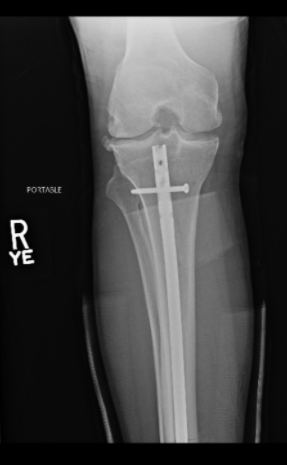 Luego de la intervención. Foto: Twitter