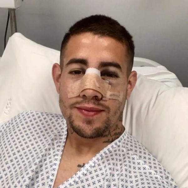 Rodrigo Holgado se operó el miércoles pasado de la fractura nasal sufrida ante Melipilla. Foto: Audax Italiano.