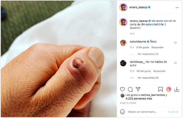 La publicación de Álvaro López tras compartir el estado de su dedo, tras el corte que sufrió en el primer episodio de Masterchef Celebrity.(1)