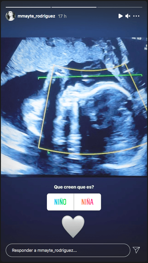 Mayte Rodríguez agradece apoyo, revela su “antojo más potente hasta ahora” y muestra primera imagen de su bebé.(3)