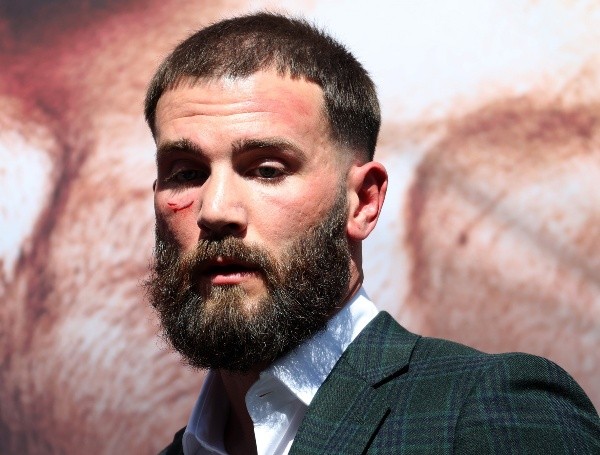 Así quedó el rostro de Caleb Plant tras su cara a cara con Saúl Canelo Álvarez. Foto: Getty Images
