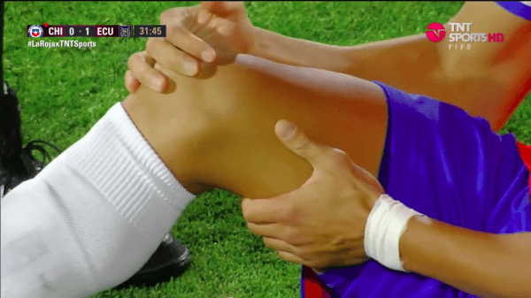 Alexis se lesionó