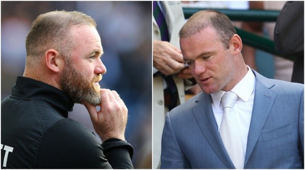 Rooney se sometió a un tratamiento para aumentar su cabello y también su barba, creando tendencia en Inglaterra.