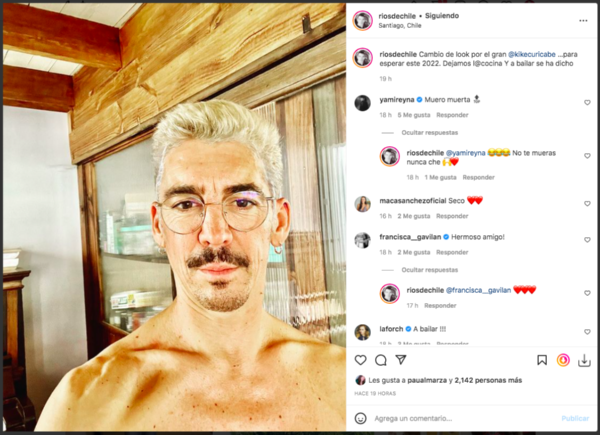 Felipe Ríos sorprende con drástico cambio de look.(2)