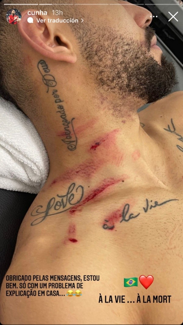 Matheus Cunha mostró en sus redes sociales como le quedó el cuello después de la tremenda patada que le dio Alexander Domínguez. (Foto: Captura Instagram Matheus Cunha)
