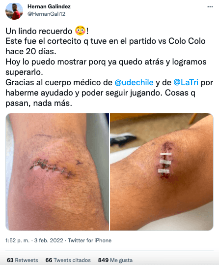 Galíndez mostró en Twitter el estado de su rodilla tras un choque con Juan Martín Lucero en el Superclásico jugado en Argentina. (Foto: @HernanGali12)