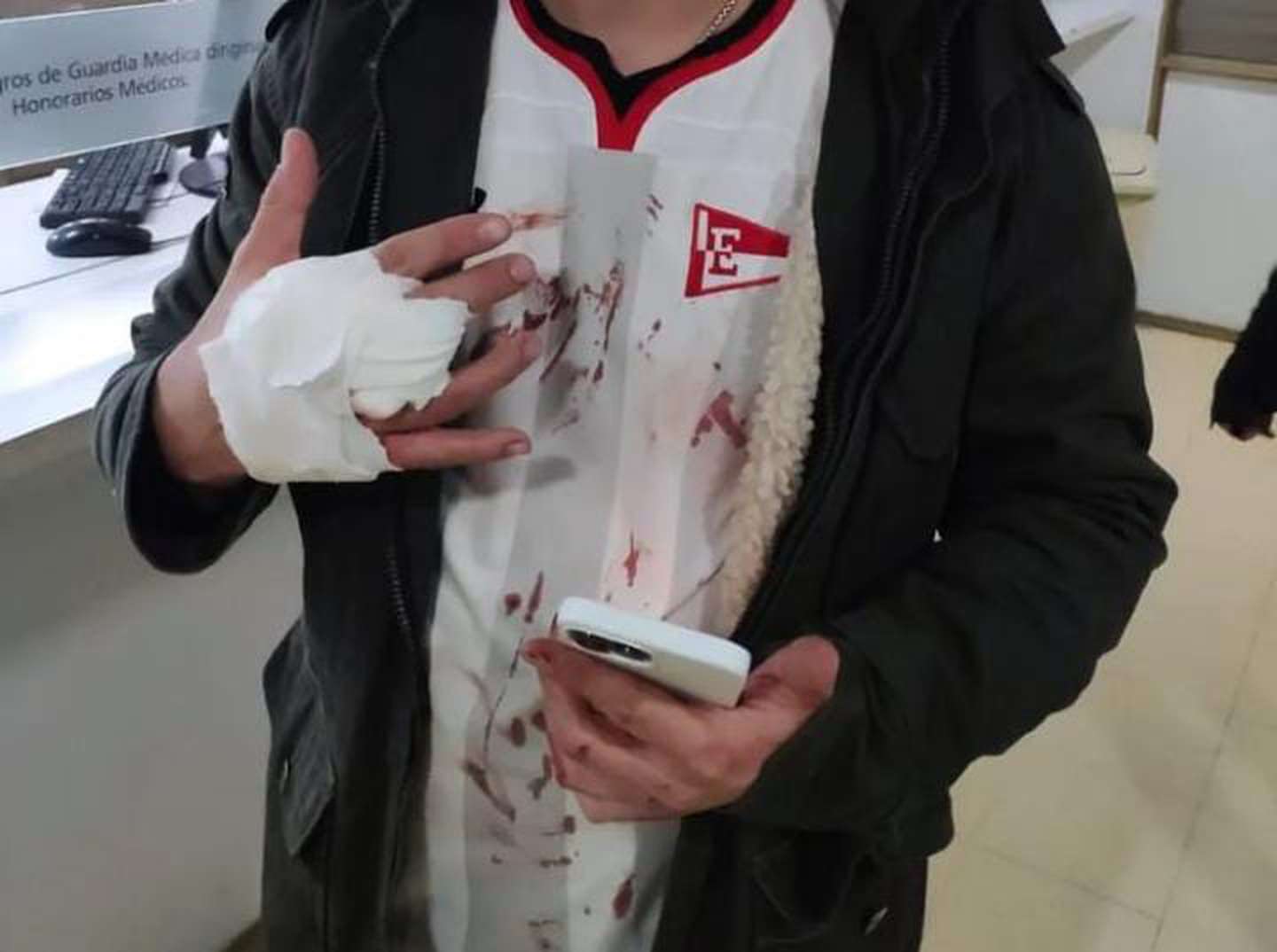 Hincha de Estudiantes herido tras la bengala lanzada por la parcialidad uruguaya (Foto: Instagram somosedlp)