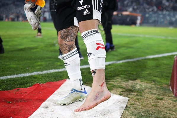 Maximiliano Falcón sufrió un duro golpe ante Huachipato. (Foto: Agencia Uno)