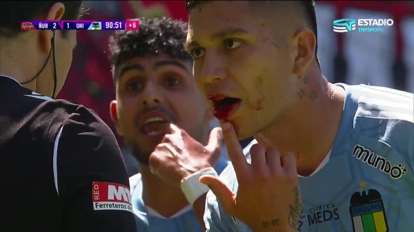 Así le quedó la boca a Diego González tras el choque con Mathias Pinto que terminó en su expulsión (Captura TNT Sports).