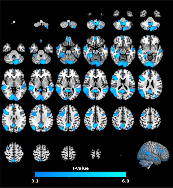 Imágenes de la actividad del cerebro de los hinchas