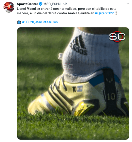 Así se vio el tobillo de Lionel Messi.