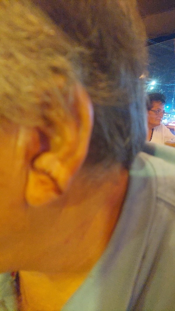 Valentini asegura haber quedado muy mal en su oído izquierdo tras ser golpeado por Encinas (Foto: Gino Valentini)