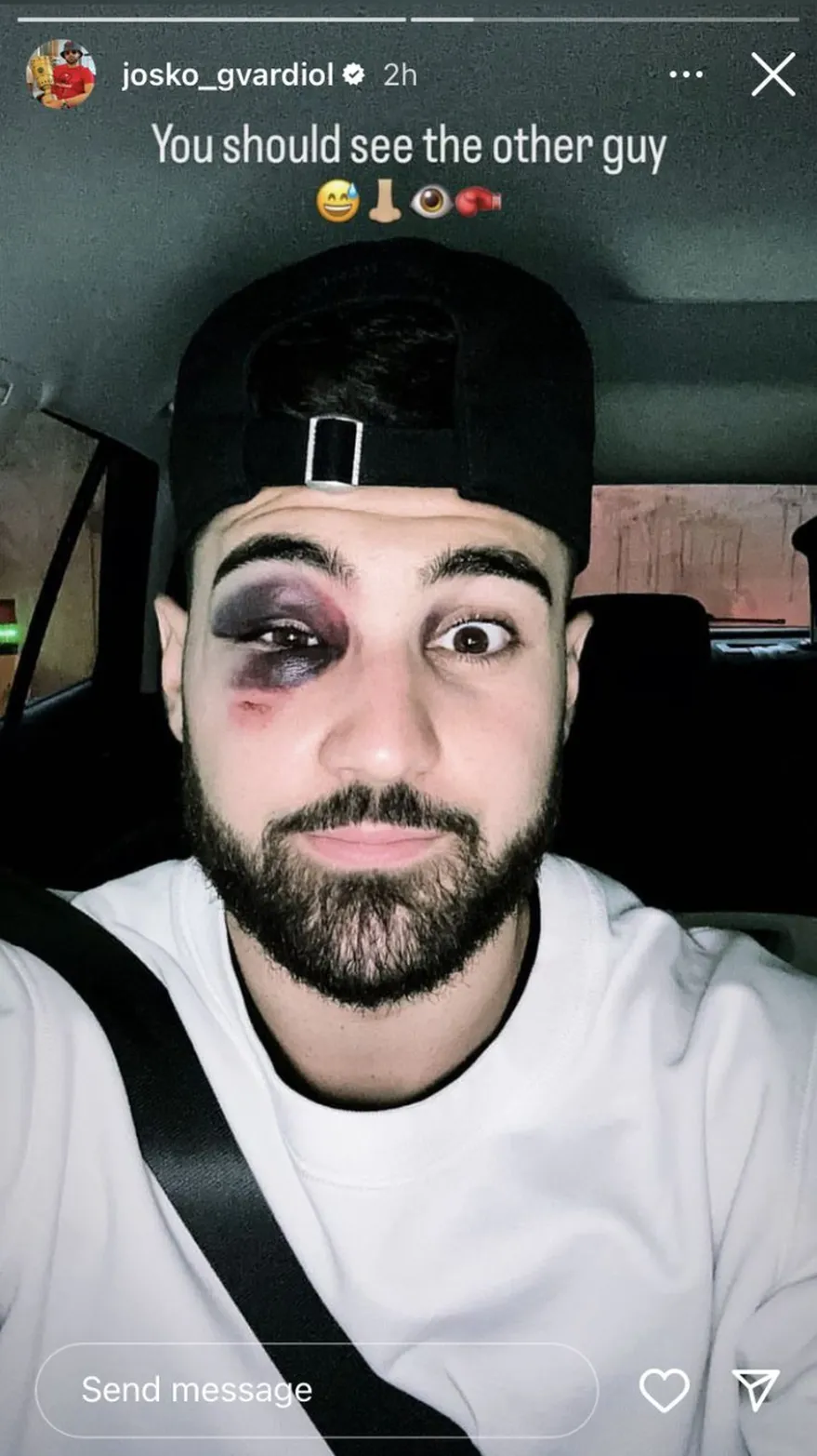 Foto subida por Gvardiol tras el partido ante Friburgo.