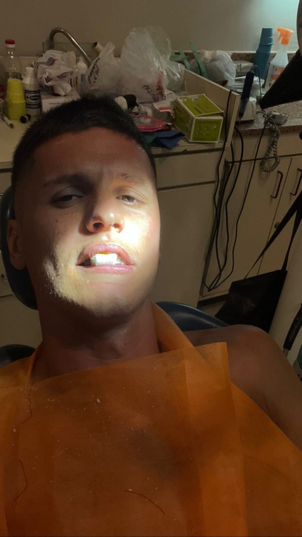 Guido Carrillo recibió tratamiento dental de madrugada. (Captura Instagram).